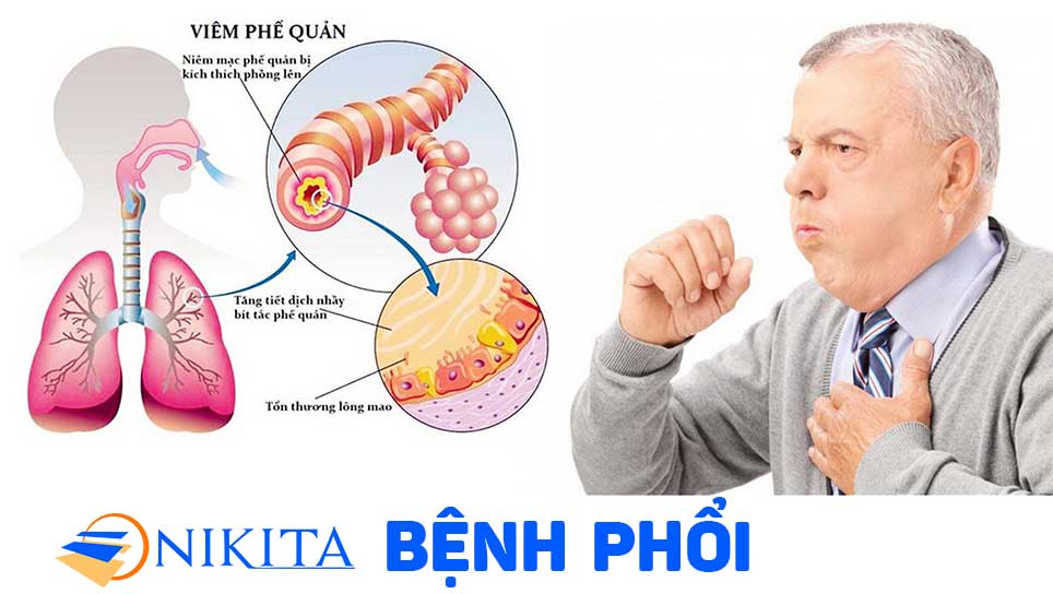 Bệnh phổi
